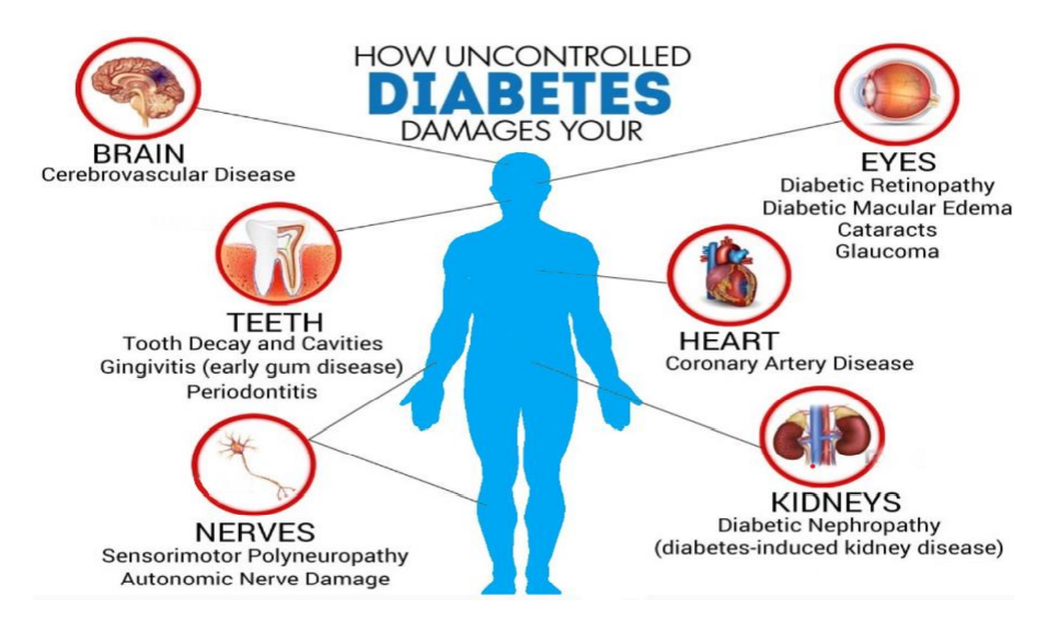 What is Diabetes? - VFIT Fitness